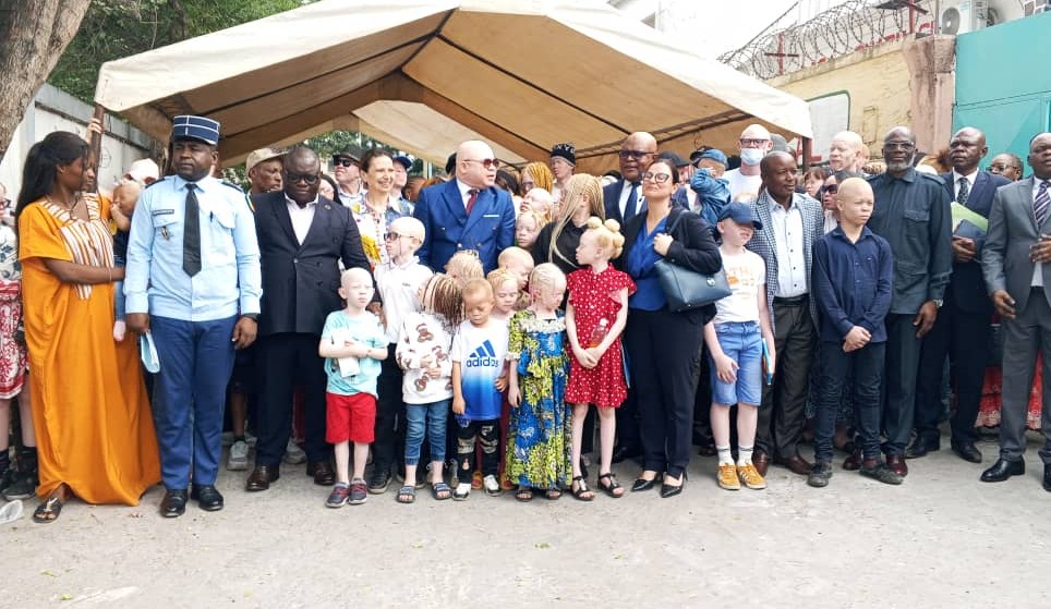 Journée internationale de l'albinisme : l'AJCA intensifie la vulgarisation de la loi 18-2025